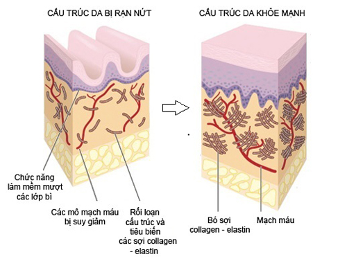 Mô phỏng da khỏe và da lão hóa